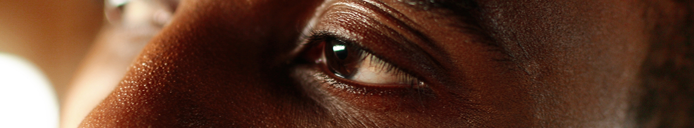 Close up of patients eyes