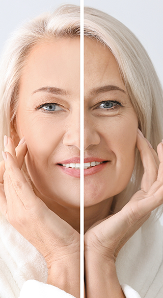 Woman before and after BOTOX treatment