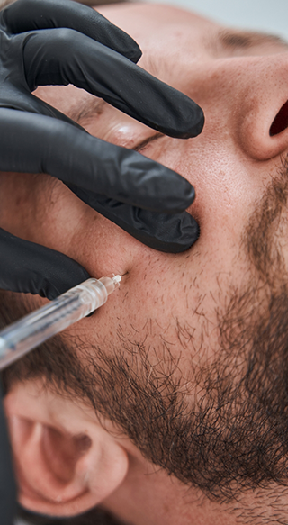 Man receiving Restalyne filler in cheek